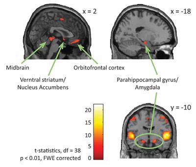 Music-Evoked Reward and Emotion: Relative Strengths and Response to Intervention of People With ASD